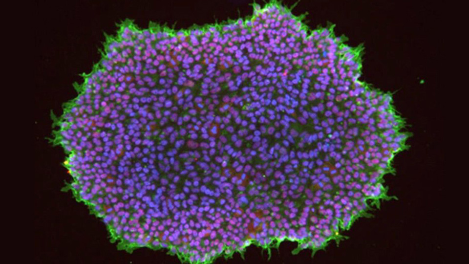 A fluorescent microscopy image showing a large cluster of cells with bright purple centers and green outlines against a dark background.