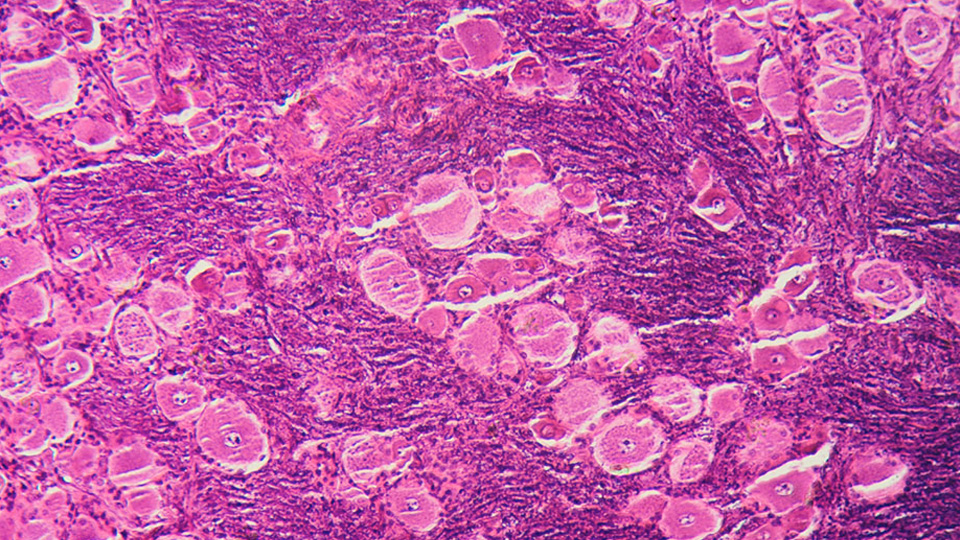 Microscope image of pink and purple organ tissue showing densely packed cells with varied shapes and textures, highlighting the structural organization of biological tissues.